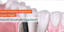İmplant